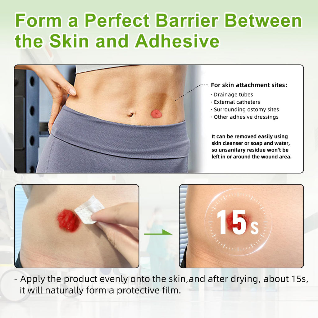 Carbou Skin Barrier Wipes, 100Pcs Skin Prep Wipes for Ostomy