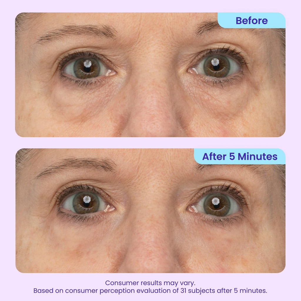 goPure NEW Instant Lift Eye Gel - To Imrove the look of Eye Bags, Wrinkles, Fine Lines and Dark Circles, Anti Aging Skin Care with MaxLift3 Biotech