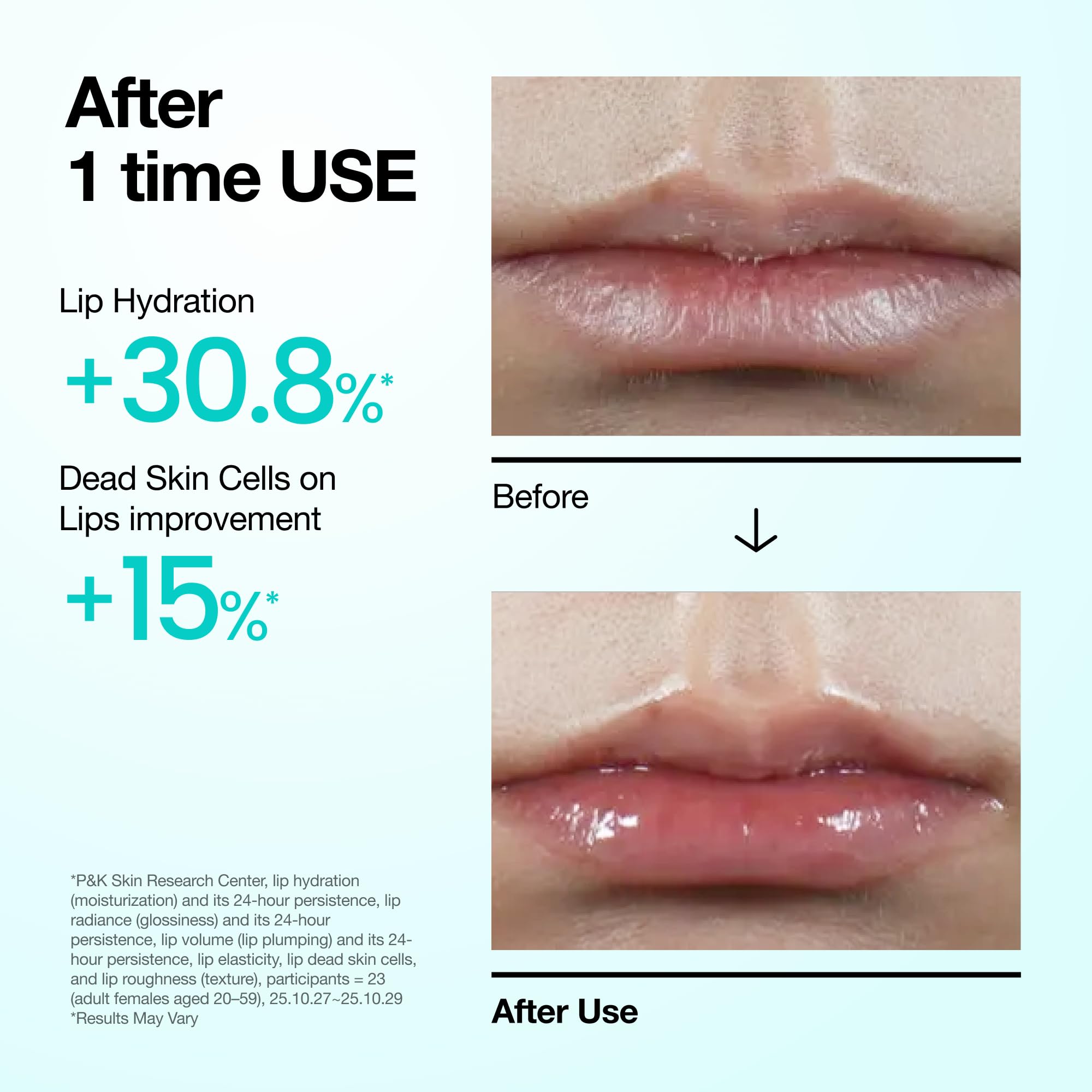 Anua PDRN Lip Serum, 0.33 fl.oz | Long-lasting Hydration for Dry Skin, Non-Sticky Moisturizing Lip Care with Salmon DNA, Hyaluronic Acid & Collagen