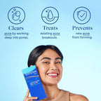 Differin Acne Retinoid Treatment Gel, 0.1% Adapalene, 15g Pump | 30-Day Supply, OTC Retinoid Clears Acne At The Source, Gentle On Sensitive Skin, Dermatologist Recommended