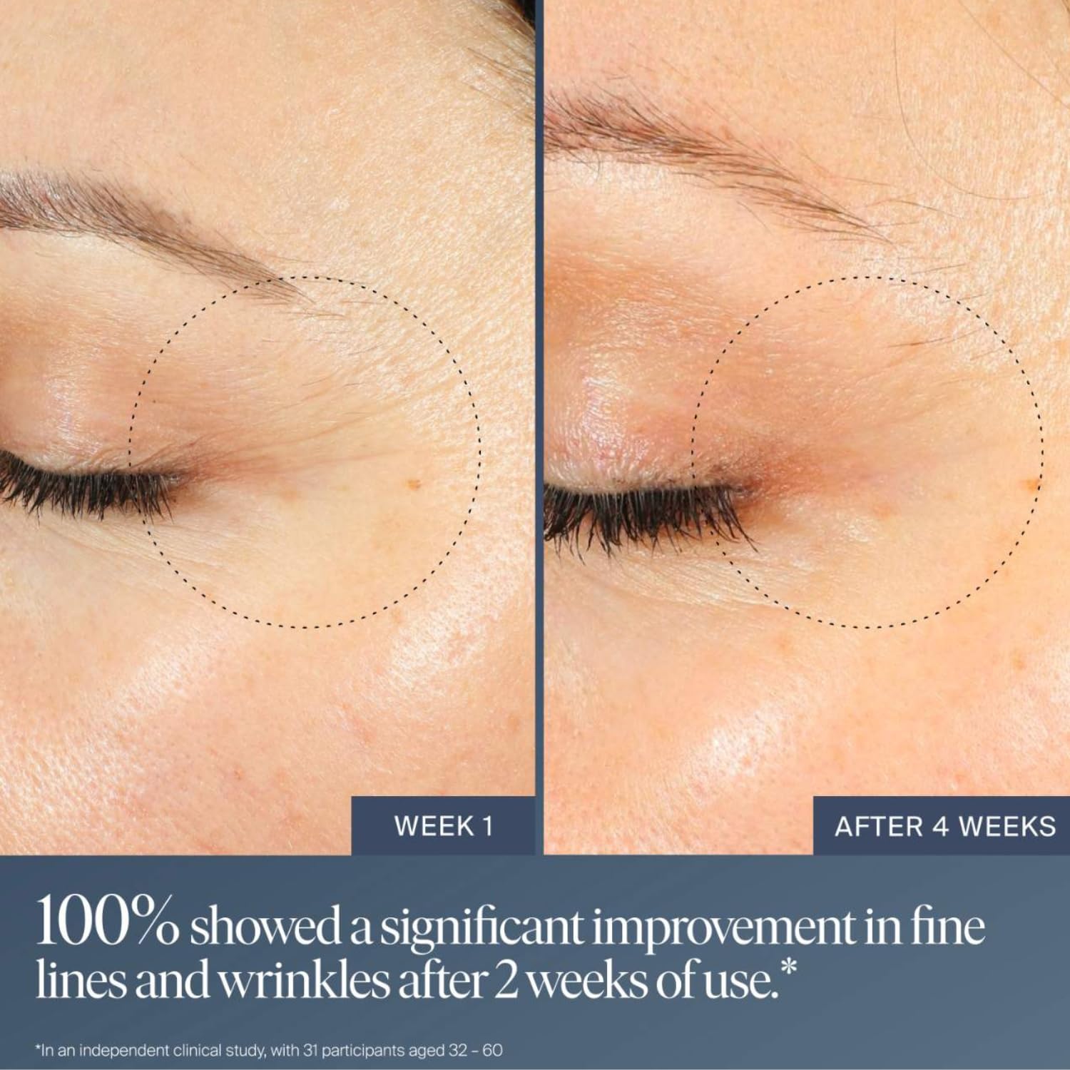 Buy now Summer Fridays Jet Lag Overnight Eye Serum - Nourishing Undereye Treatment for Dark Circles - Helps to Hydrate, Smooth, Firm & Depuff - Enriched with Glycerin to Lock in Moisture (0.5 Fl Oz) at indiglob india