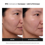 Paula's Choice CLINICAL 1% Retinol Face Treatment with Peptides | Anti-Aging Face Serum with Vitamin C & Licorice Extract for Fine Lines & Wrinkles, Fragrance Free
