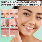 Blackhead Remover Peel Off Mask