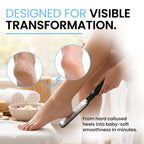 Colossal Foot rasp Foot File and Callus Remover. Best Foot Care Pedicure Metal Surface Tool to Remove Hard Skin. Can be Used on Both Wet and Dry feet, High Grade Stainless Steel File