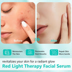 Red Light Therapy Activation Serum, Red Light Therapy Serums for Face and Neck, Hydrating Serum for Face, Facial Serums Anti Aging and Reduce Wrinkles, Pure Formula Facial Serum for Women, 1OZ