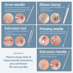 Blackhead Remover Comedone Extractor Acne Removal Kit..