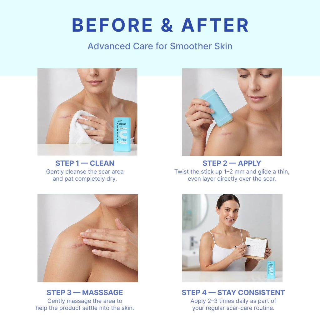Suquato Silicone Scar Stick – Silicone Keloid Scar Removal Cream for Face & Body, Helps Improve Surgical Scars, C-Section, Acne Scars & Stretch Marks, Portable Twist Stick– 20g