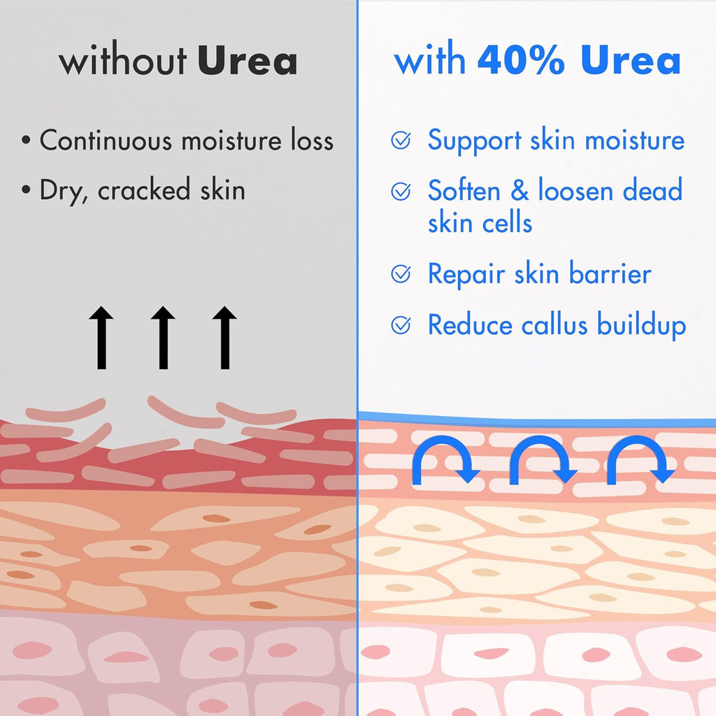 Buy now Ebanel Urea Cream 40% plus Salicylic Acid 2%, Foot Cream for Dry Cracked Heels Feet Knees Elbows Hands, Foot Dead Skin Cuticle Callus Remover Toenail Softener, Keratolytic Skin Barrier Repair at indiglob india