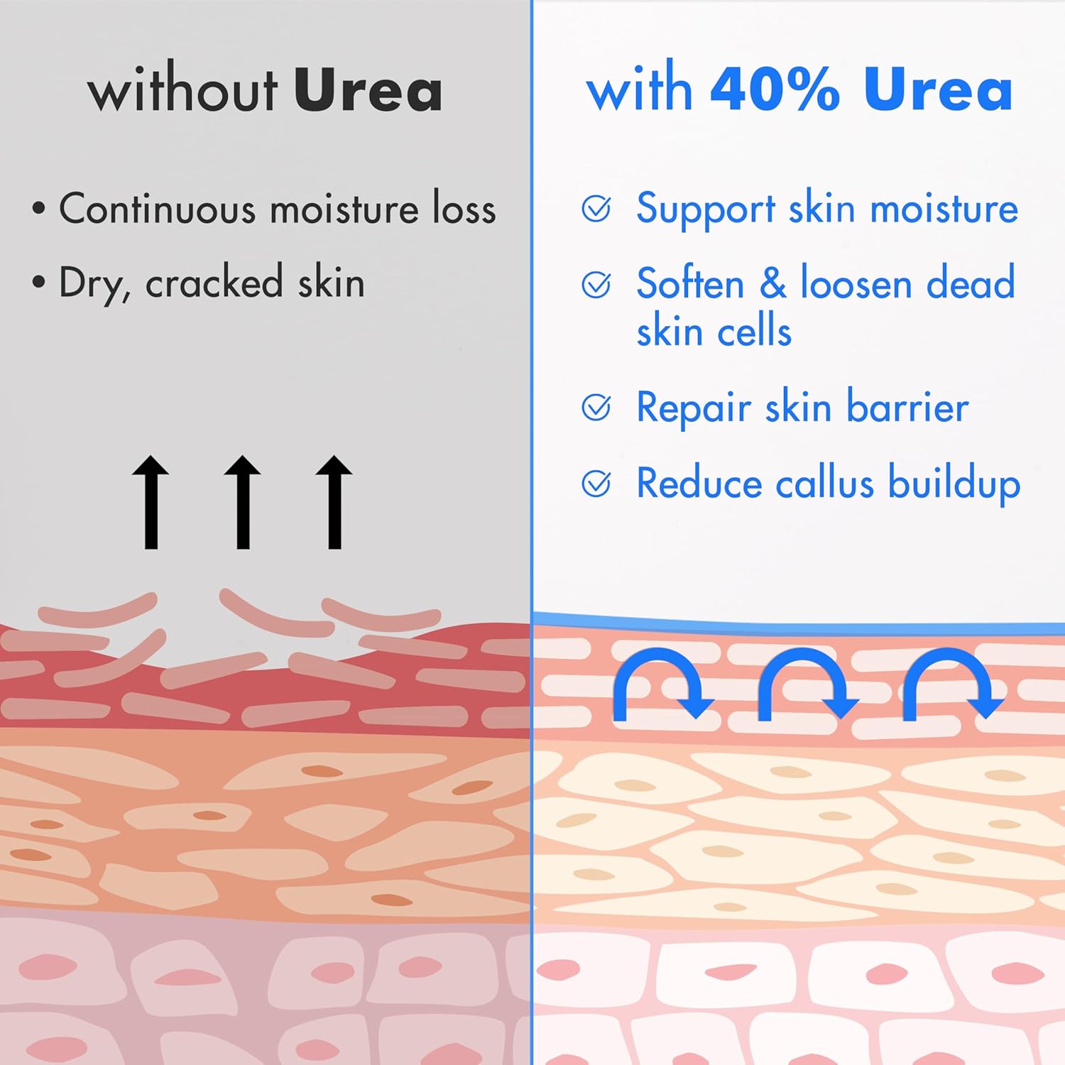 Buy now Ebanel Urea Cream 40% plus Salicylic Acid 2%, Foot Cream for Dry Cracked Heels Feet Knees Elbows Hands, Foot Dead Skin Cuticle Callus Remover Toenail Softener, Keratolytic Skin Barrier Repair at indiglob india