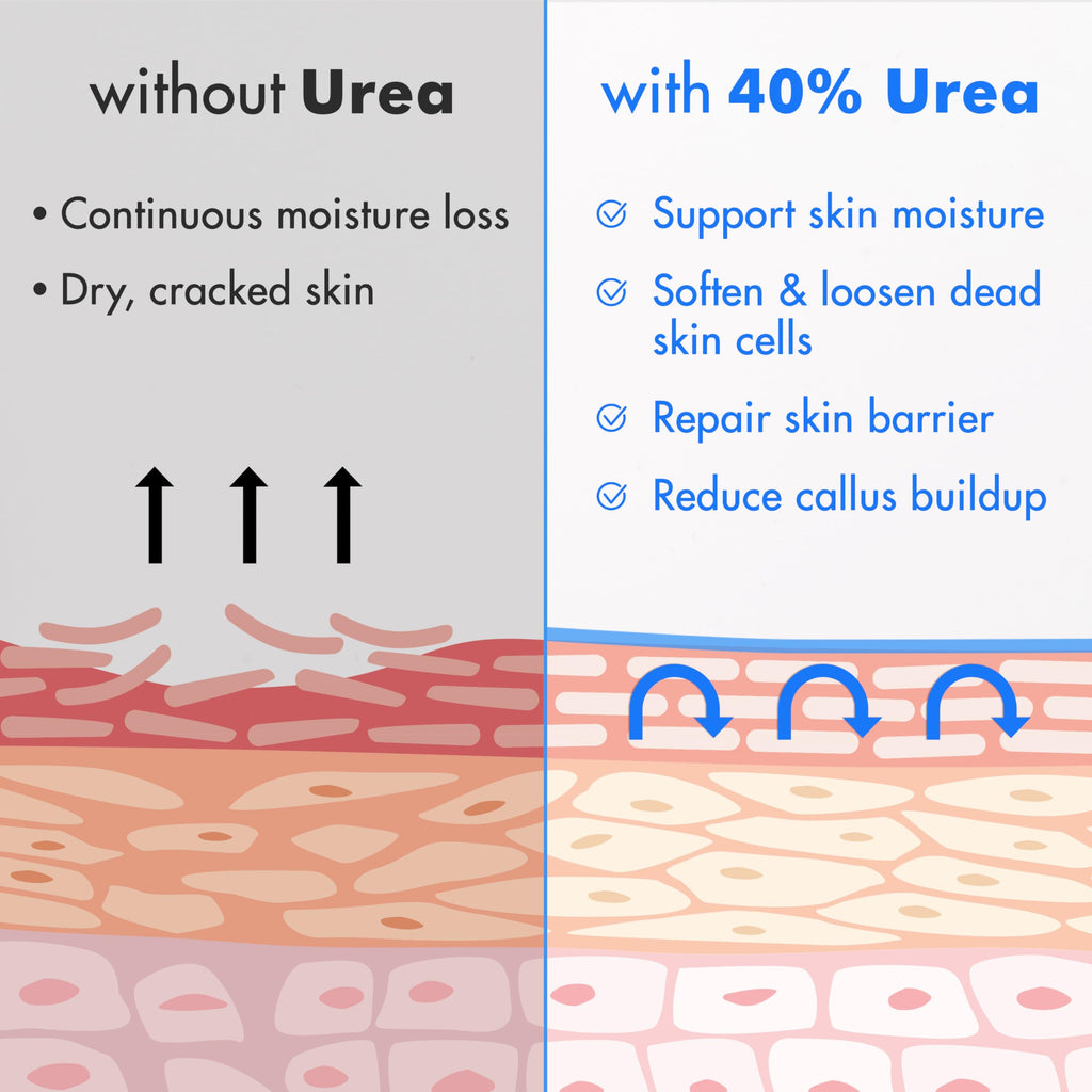 Ebanel Urea Cream 40% plus Salicylic Acid 2% for Dry Cracked Feet Skin | Deeply Moisturizes & Softens Dry Cracked Heels, Feet, Knees, Elbows, Hands, Rough Dead Skin Callus Remover Toenail Softener