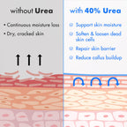 Ebanel Urea Cream 40% plus Salicylic Acid 2% for Dry Cracked Feet Skin | Deeply Moisturizes & Softens Dry Cracked Heels, Feet, Knees, Elbows, Hands, Rough Dead Skin Callus Remover Toenail Softener