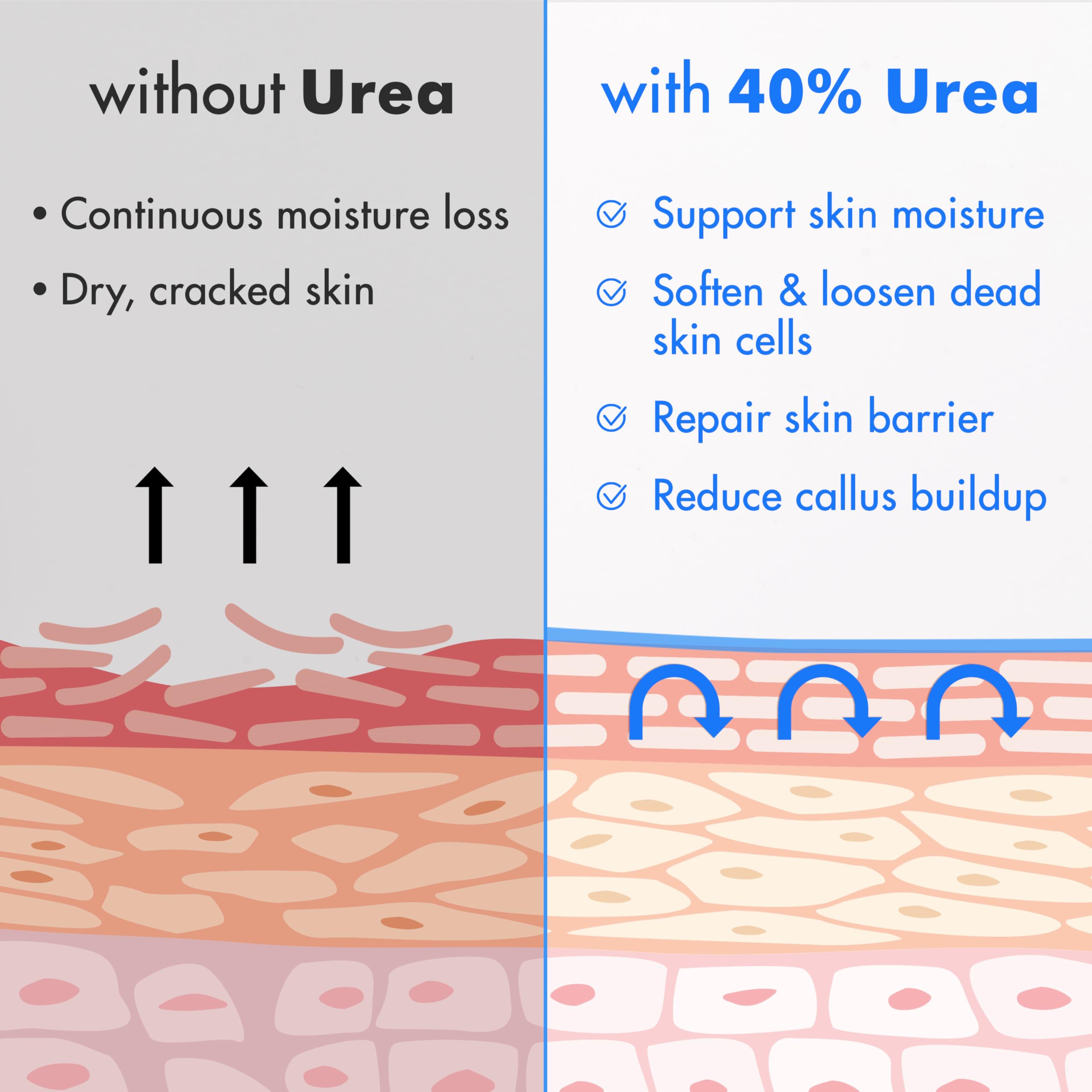 Ebanel Urea Cream 40% plus Salicylic Acid 2% for Dry Cracked Feet Skin | Deeply Moisturizes & Softens Dry Cracked Heels, Feet, Knees, Elbows, Hands, Rough Dead Skin Callus Remover Toenail Softener