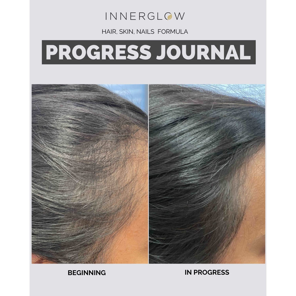 Inner Glow Advanced Hair, Skin & Nails Vitamins – Doctor-Developed Hair Supplement with Biotin, Collagen Peptides, Vitamin D & B12 – Clinically Tested 12-Week Results, Made in USA, Non-GMO