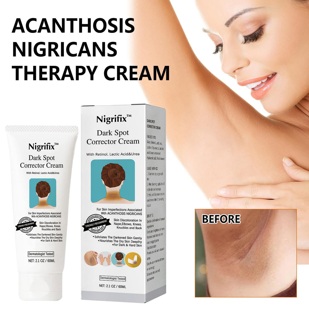 Acanthosis Nigricans Therapy Cream,Dark Spot Remover For Body,Dark Spot Corrector Cream,- Underarm, Neck, Armpit, Knees, Elbows, Private Areas, Intimate Areas - Upgraded Formula, - 2.1Fl Oz