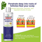 PHARMBANNER Anti-Fungal Shampoo for Folliculitis, Seborrheic Dermatitis, Scalp Psoriasis - Relieves Itchy & Dry Scalp