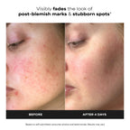 Paula's Choice BOOST 10% Azelaic Acid Booster Cream Gel Serum | Oil-Free Serum Fades Discoloration & Post-Blemish Marks with Licorice Extract & Salicylic Acid, Fragrance-Free