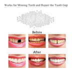 Buy now Tooth Repair Kit-Thermal Beads for Filling Fix The Missing and Broken Tooth or Adhesive The Denture Fake Teeth at indiglob india