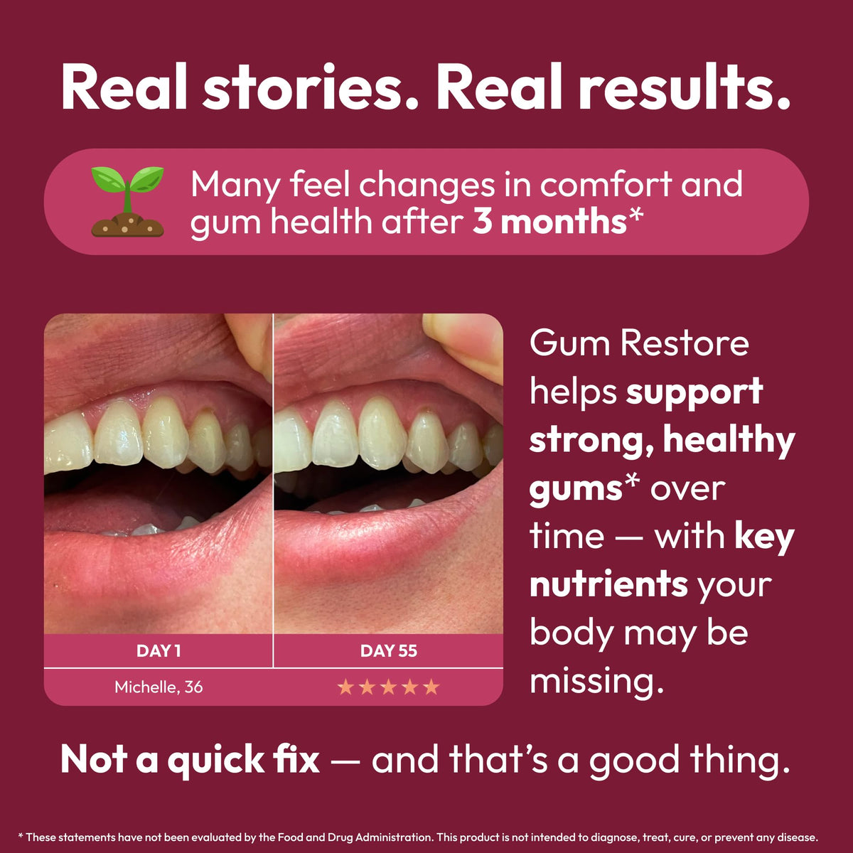 Strong Jaw Gum Restore - Gum Health Supplement for Adults - 180 Capsules