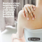 De La Cruz 10% Sulfur Ointment, Cystic Acne Treatment Face, Body 2.6oz jar | Maximum Strength Sulfur Acne Treatment, Helps Clear Pimples, Antibacterial & Anti-inflammatory, Non-Comedogenic, Made in USA