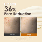 OBgE Oil Control Finisher - Bouncy Jelly Texture Sebum Control Powder, Matte Finish Face Powder for Oily Skin, Instant Pore Blur & Shine Control, Translucent Setting Powder, No Fallout, 0.17 oz