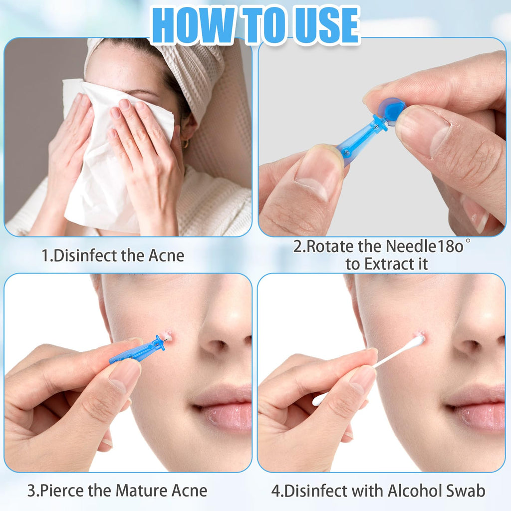 Lancets for Facial Extraction, 100Pcs Disposable Acne Needle | Effective Blemish and Blackhead Removal Tools for Clear Skin