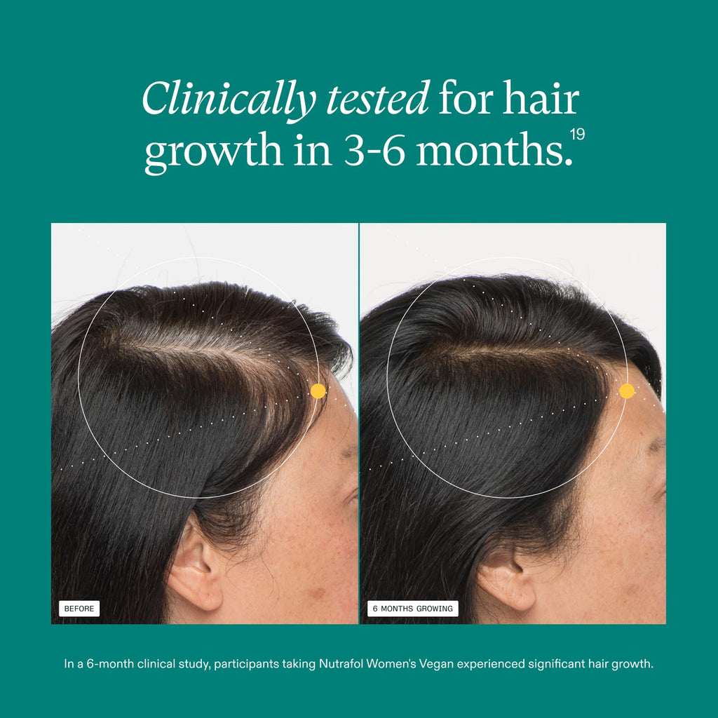 Nutrafol Women Hair Growth Supplements, Ages 18-44, Vegan, 1-Month Bottle | #1 Dermatologist-Recommended Hair Growth Supplement Brand, Clinically Tested for Visibly Thicker Hair and Scalp Coverage