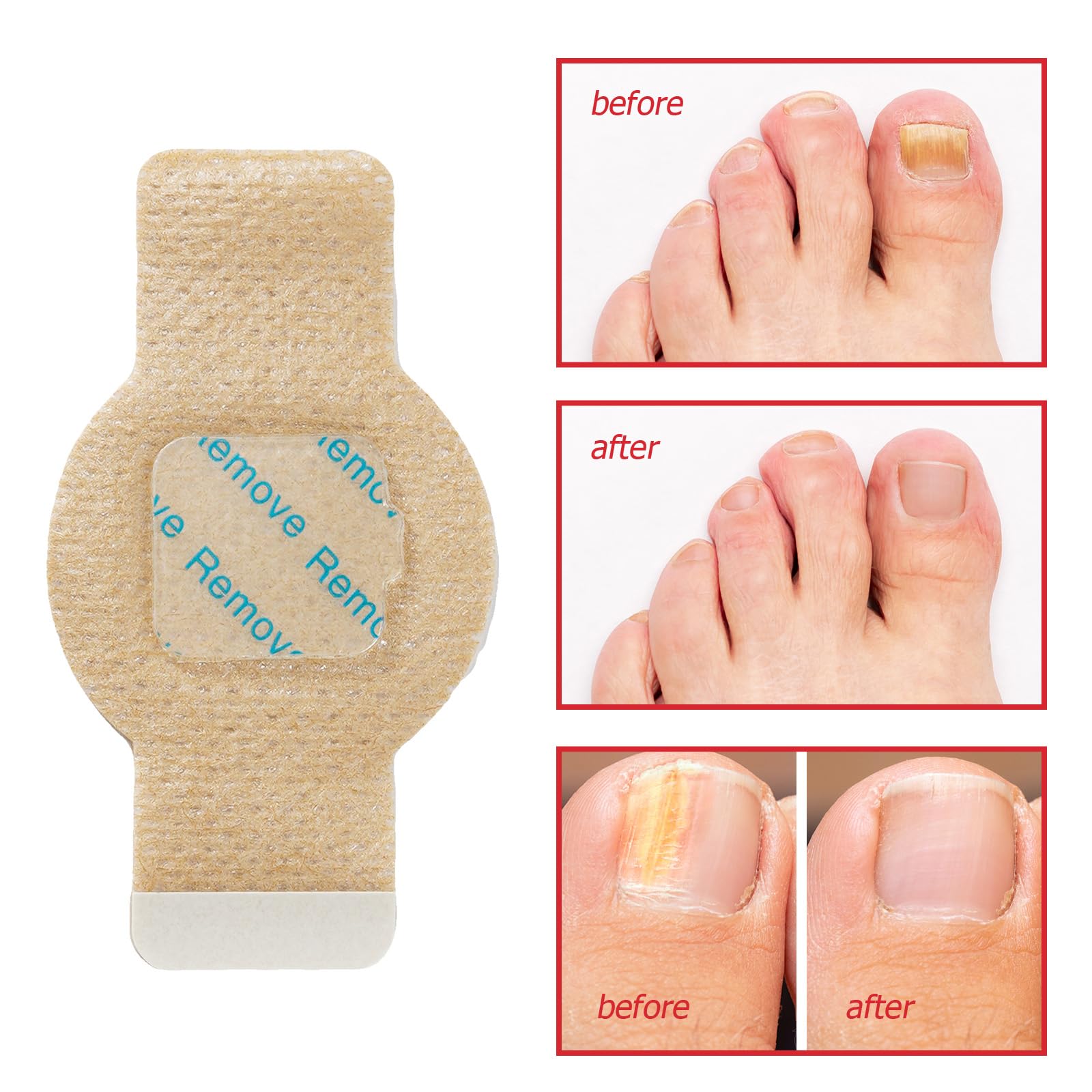 Toenail Care Patches, Nail Patches for Thick & Discolored Nails, Nail Conditioning Formula, Self-Adhesive Nail Care Stickers, 21 Patches