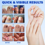 Nail Patches 21 PCS, Toenail Treatment Extra Strength 8-Hour Overnight Nail Fast Acting Repair Effortless Hydrogel Nail Care and Repair for Damaged Nails Overnight Renewal for Men and Women