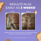 MaryRuth's Hair Growth Max Liposomal 10000mcg Biotin, Thicker Hair, 15.22oz | Lustriva® + Pumpkin Seed Oil, Hair Care, Wrinkles, Fine Lines, Skin Care, Ages 18+