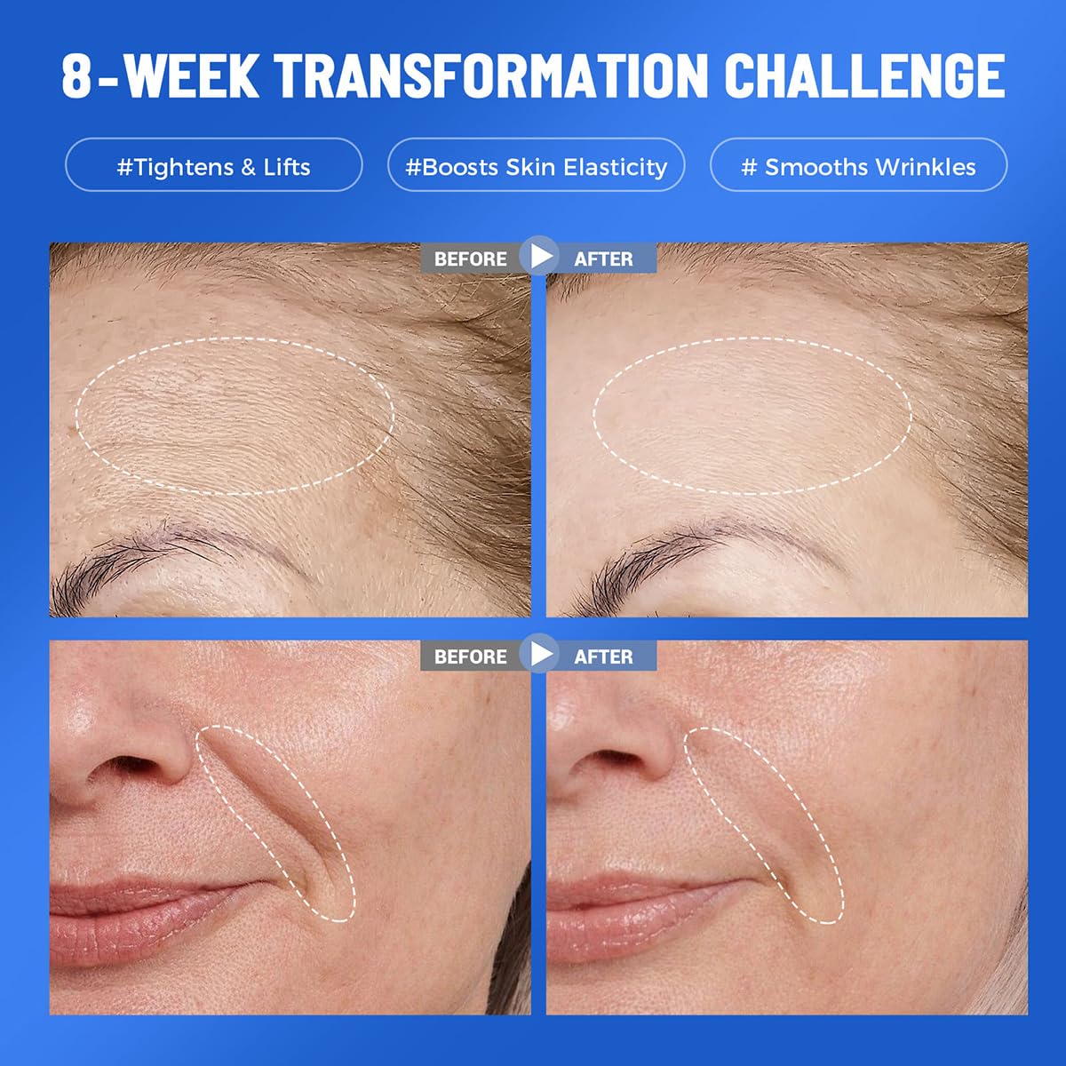 Okela 7 Pack Collagen Hydrogel Overnight Face Mask, Deep Hydrating Moisturizing Mask for Smoother, Firmer Skin, Revitalizing Skin Care Gift for Women