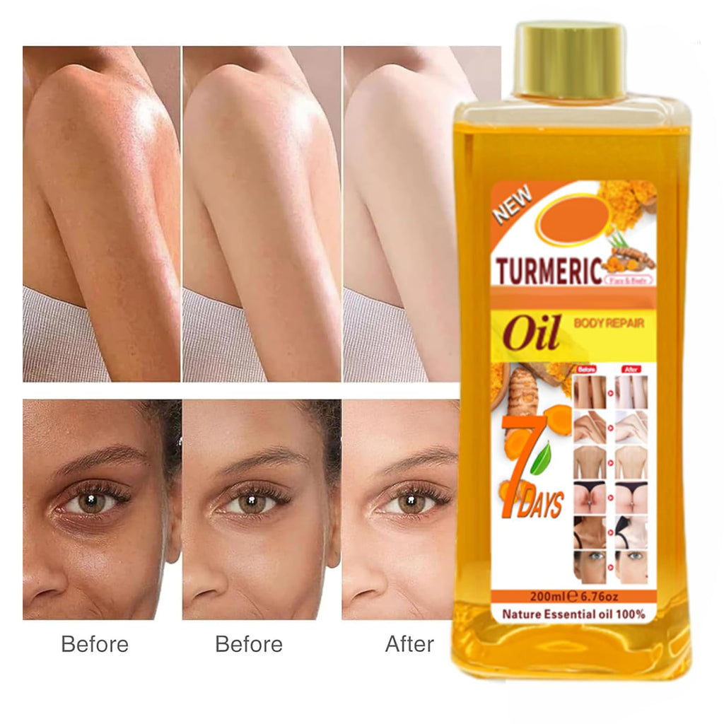 Turmeric Oil for Skin, Soft 7 Turmeric Oil, Natural Moisturizing Nourishing for Face and Body, Vitamin E Body Oil, for All Skin Types