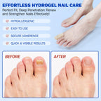 Nail Patches 21 PCS, Toenail Treatment Extra Strength 8-Hour Overnight Nail Fast Acting Repair Effortless Hydrogel Nail Care and Repair for Damaged Nails Overnight Renewal for Men and Women