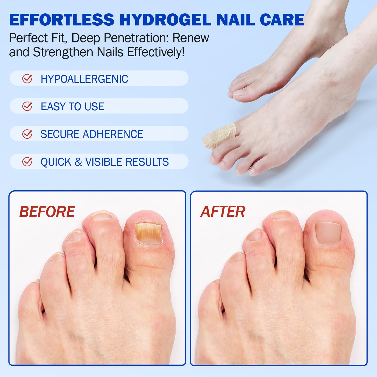 Nail Patches 21 PCS, Toenail Treatment Extra Strength 8-Hour Overnight Nail Fast Acting Repair Effortless Hydrogel Nail Care and Repair for Damaged Nails Overnight Renewal for Men and Women