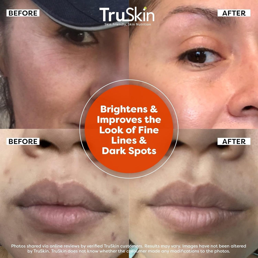 Buy now TruSkin Vitamin C Serum For Face â€“ Anti Aging Face Serum with Vitamin C, Hyaluronic Acid, Vitamin E â€“ Brightening Formula â€“ Improve Appearance of Dark Spots, Tone, Fine Lines & Wrinkles, 1 Fl Oz at indiglob india