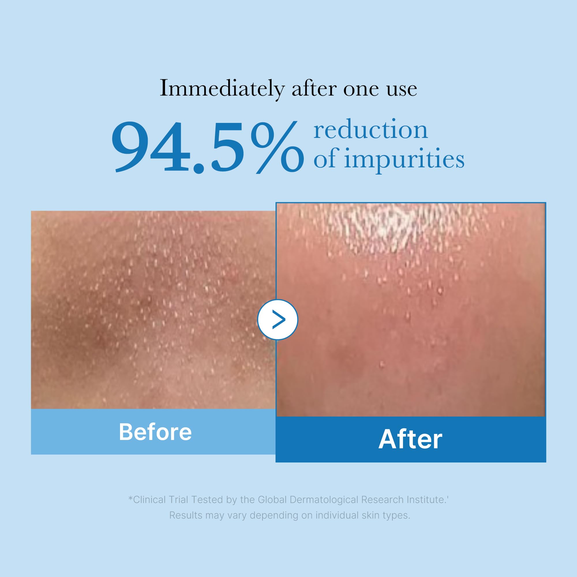 medicube Cleansing Oil Zero Pore Blackhead | Makeup Remover for all skin types, Daily Moisture Facial Cleanser, Low-Irritation, Korean Skin Care, 205ml / 6.93 fl.oz
