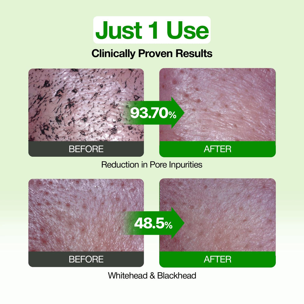 FULLY Green Tomato Pore Clay Mask Cleanser for Deep Cleansing, 4.05 fl oz | Clay Pack Cleanser for Deep Pore Cleansing, Blackhead & Sebum Control, Gentle Korean Face Wash for Oily & Combination Skin