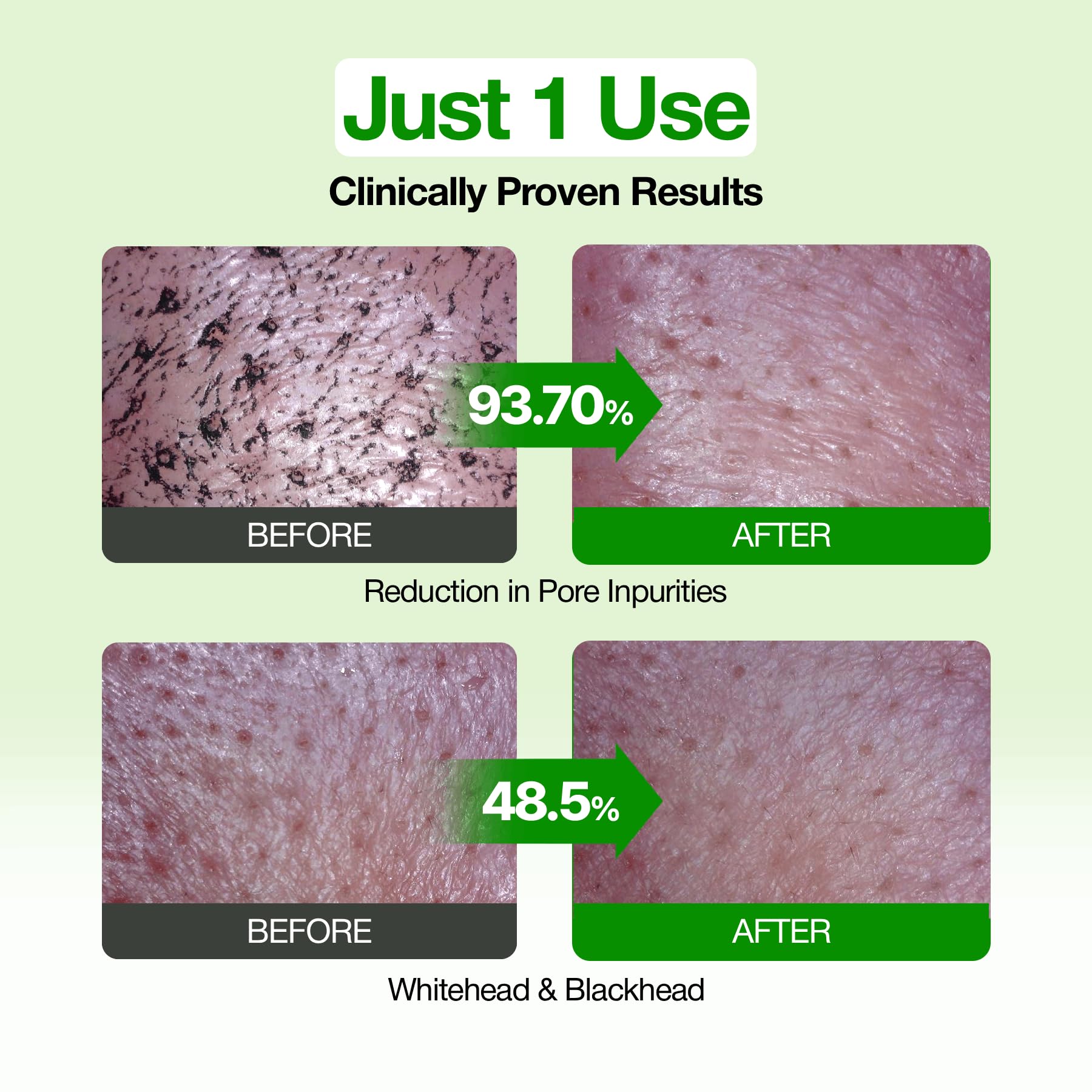 FULLY Green Tomato Pore Clay Mask Cleanser for Deep Cleansing, 4.05 fl oz | Clay Pack Cleanser for Deep Pore Cleansing, Blackhead & Sebum Control, Gentle Korean Face Wash for Oily & Combination Skin