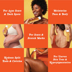 Bio-Oil Fragrance-Free Body Oil Serum for Scars & Stretch Marks, 6.7 fl oz | Dry Skin Moisturizer, Rosehip & Chamomile Oils, Scar Treatment, Stretch Mark Oil, Sensitive Skin Safe, Face and Body