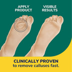 Buy now Dr. Scholl's CALLUS REMOVER Seal & Heal Bandage with Hydrogel Technology, 4ct // Removes Calluses Fast And Provides Cushioning Protection Against Shoe Pressure And Friction For All-Day Pain Relief at indiglob india