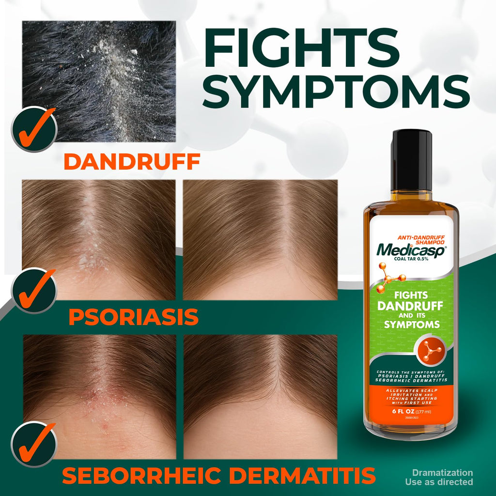 Medicasp Coal Tar Anti-Dandruff Shampoo, Flakes Shampoo, 6 fl oz, 2 Pk | Alleviates Symptoms from 1st Wash, Treats Psoriasis, Seborrheic Dermatitis & Itchy Dry Scalp, Fights Root Cause of Dandruff