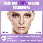 High Frequency Facial Wand-UUPAS Portable Handheld High Frequency