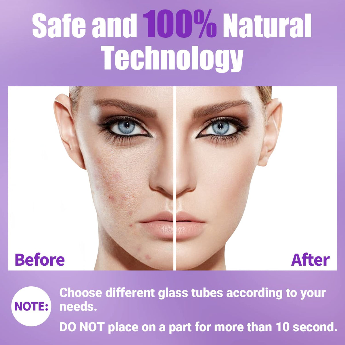 High Frequency Facial Wand-UUPAS Portable Handheld High Frequency