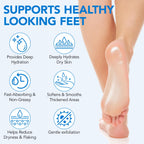 Uruses Urea Cream 60% plus Salicylic Acid 2% Urea Foot Care Stick, Foot Cream for Foot Callus Remover, Feet Moisturizer Stick for Dry Cracked Heels, Hands, Knees, Hydrating Heel Balm, Easy To Use