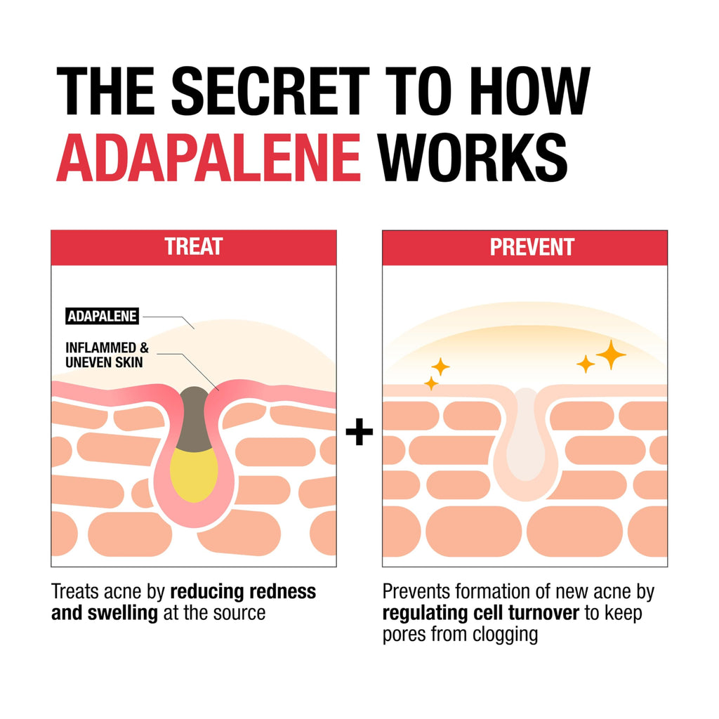 Buy now Neutrogena 0.1% Adapalene Gel Acne Treatment, Topical for Acne, Adapalene Medication for Blemishes, Once Daily Topical Retinoid to Prevent Breakouts, Oil & Fragrance-Free, 1.6 oz at indiglob india