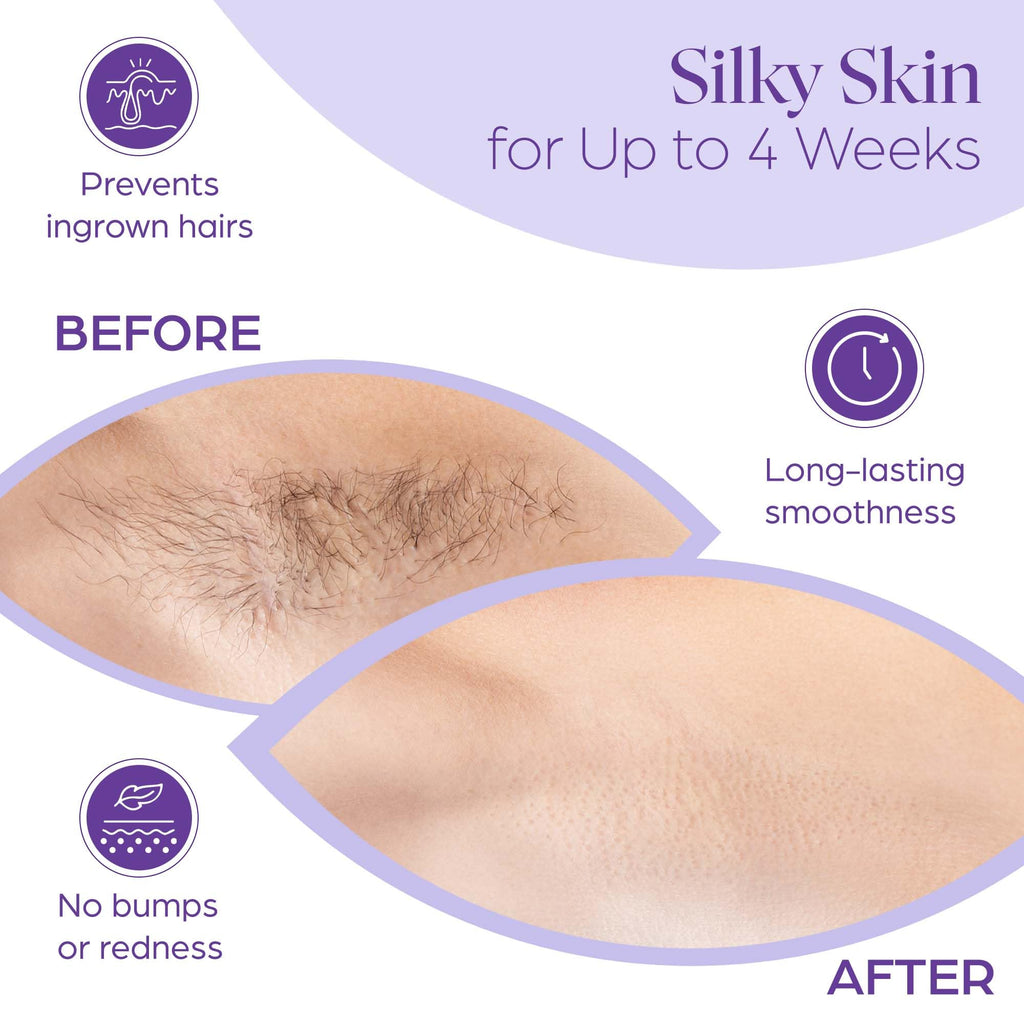 160 Wax Strips for Hair Removal – Extra-Large Non-Woven | For legs, arms, back and body · works with all soft waxes · salon and home use