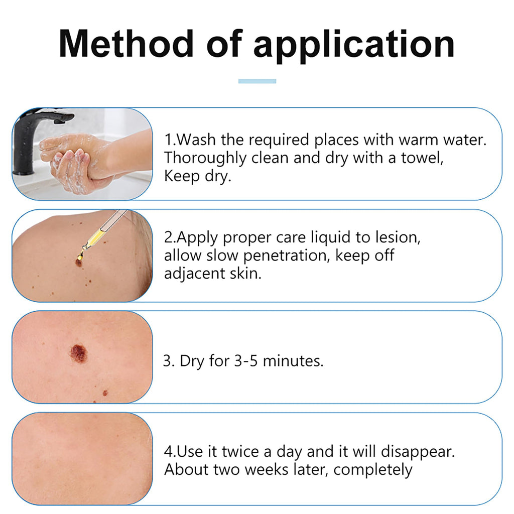 Mole & Wart Remover for Face & Body, Fast-Acting Freeze-Off