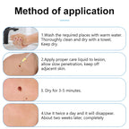 Mole & Wart Remover for Face & Body, Fast-Acting Freeze-Off