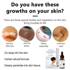 Mole & Wart Remover for Face & Body, Fast-Acting Freeze-Off