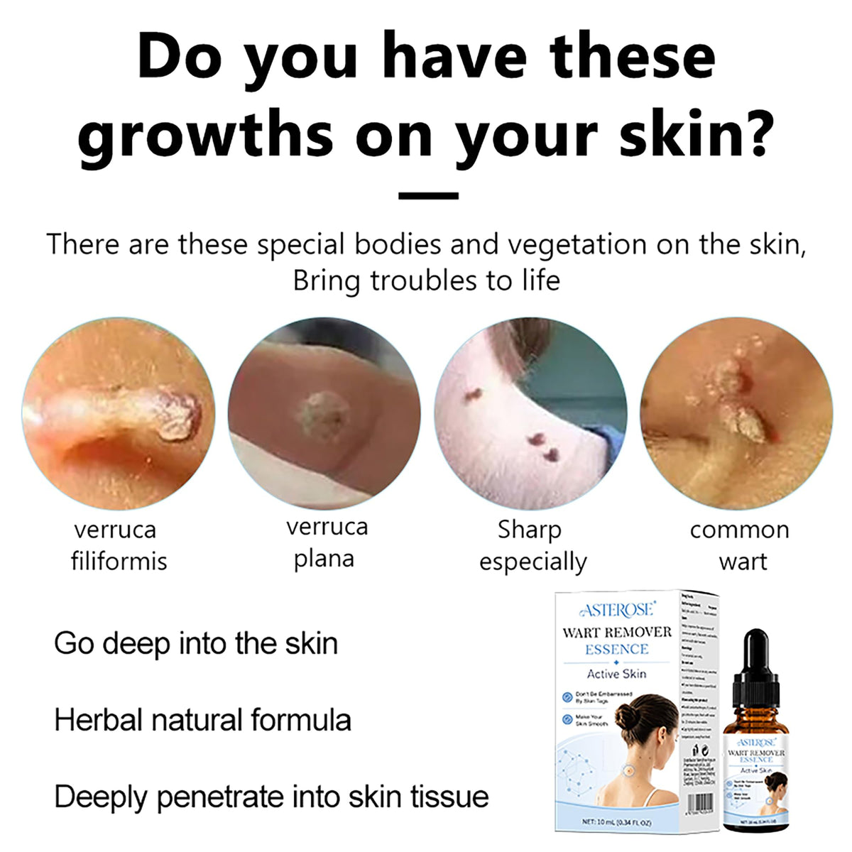 Mole & Wart Remover for Face & Body, Fast-Acting Freeze-Off