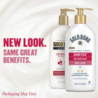 Gold Bond Diabetics' Dry Skin Relief Body Lotion for Dry Skin, With Aloe | 24-hour moisture, dry skin lotion for diabetes care, with aloe & 3 vitamins for long-lasting hydration, all-over moisturizer